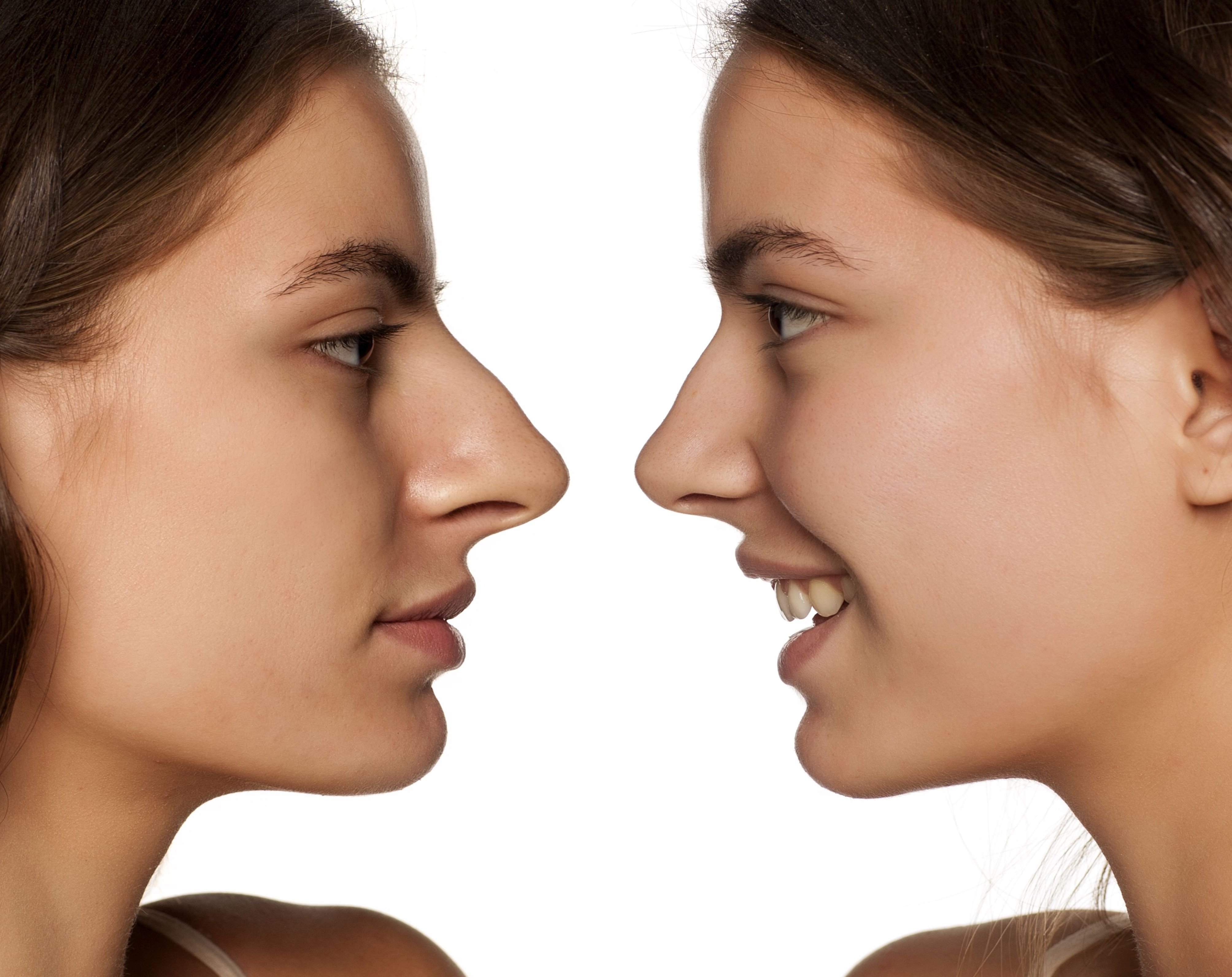 Nose Job BeranShutterstock_537206797