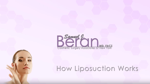 cover-how liposuction works-2