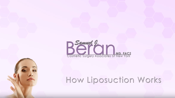 cover-how liposuction works