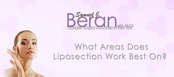 cover-what areas does lipo work best on-1